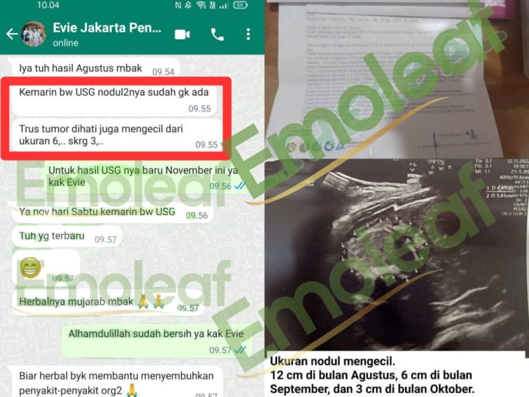 Testi-WA-Evie-768x576