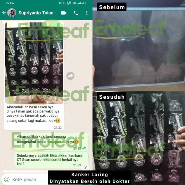 Testi-WA-Supriyanto-768x768